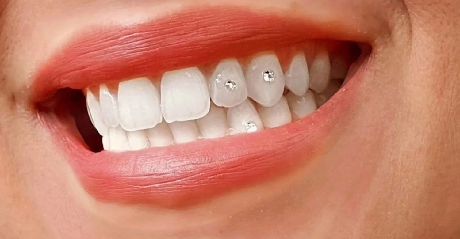 Does at home teeth whitening damage enamel1